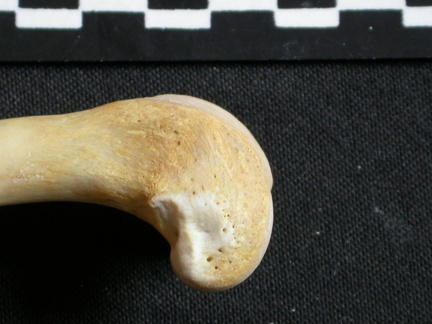 Fémur : partie distale