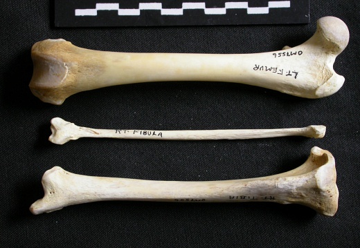  Fémur, tibia y fíbula