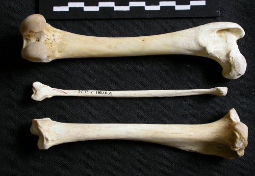  Femur, tibia and fibula