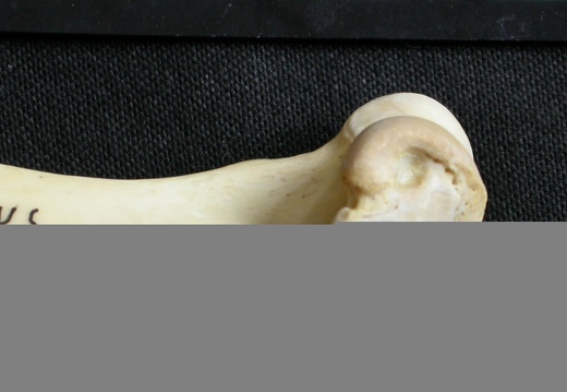 Humerus: distal part