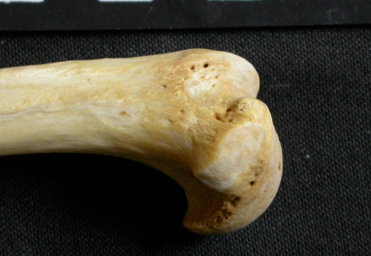 Humerus: proximale part