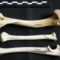 Humérus, radius et ulna