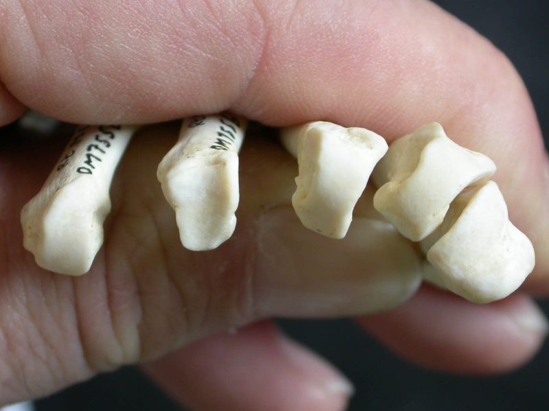 Metacarpals: proximale part