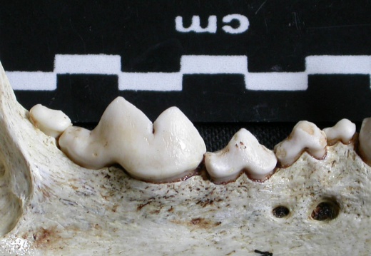 Dentición inferior