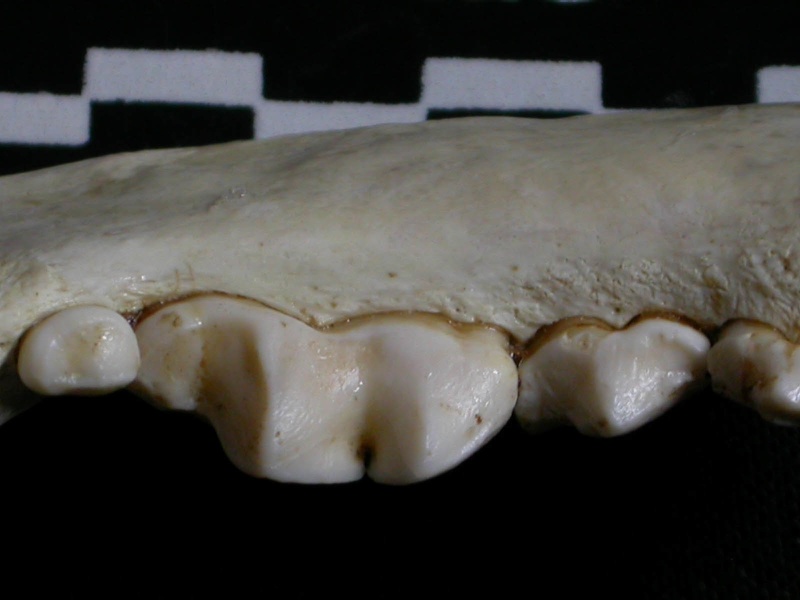 Dentition inférieure