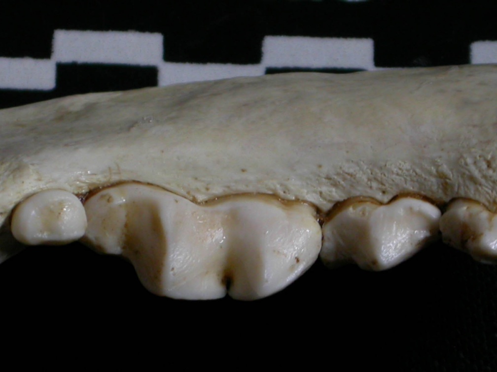 Dentition inférieure