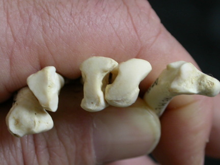 Metatarsianos : parte proximal