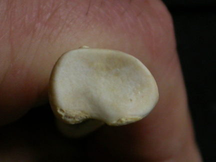 Radius : partie proximale