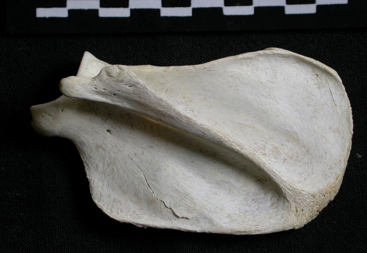 Scapula : vue latérale