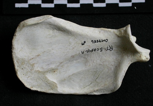 Scapula: medial view