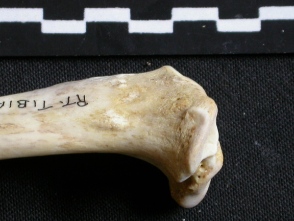 Tibia : partie proximale