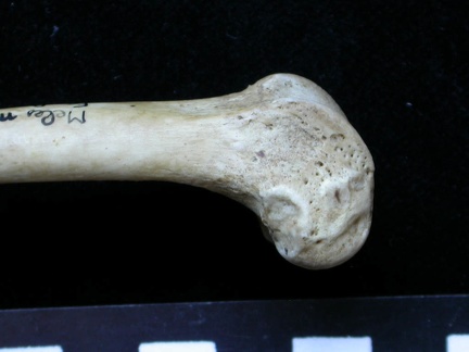 Femur: distal part