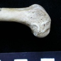 Fémur : partie distale