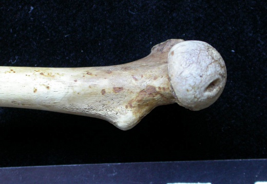 Femur: proximale part