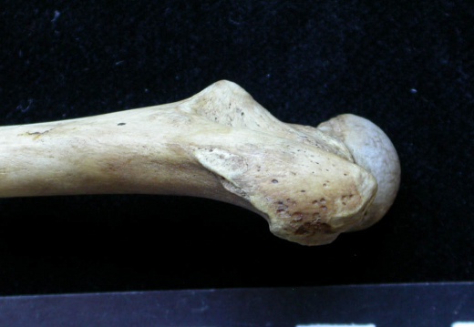 Femur: proximale part