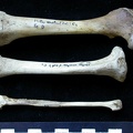 Fémur, tibia et fibula