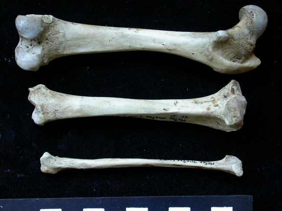 Fémur, tibia et fibula