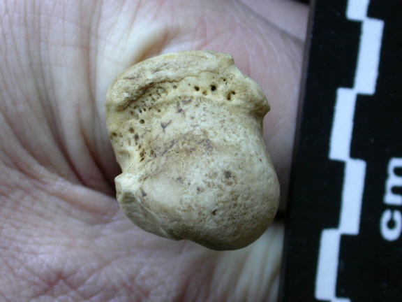 Húmero : extremo proximal