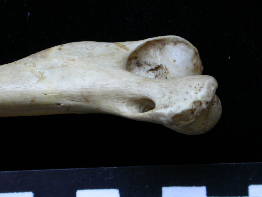 Húmero : parte distal