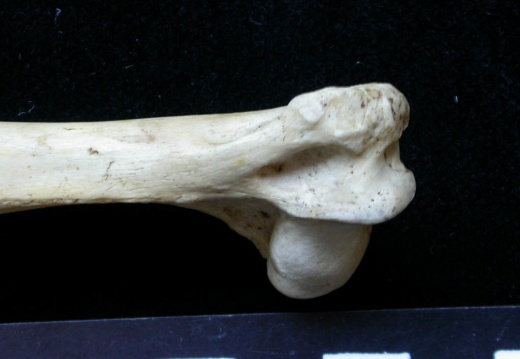 Humerus: distal part