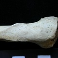 Humerus: proximale part