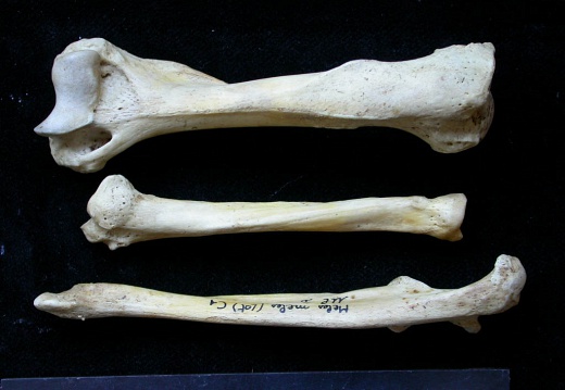 Humerus,radius and ulna