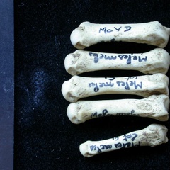 Metacarpals