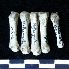 Metacarpals