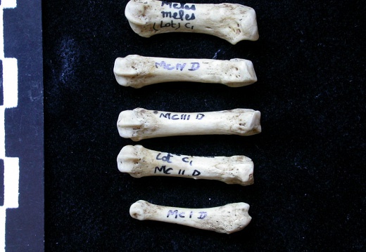 Metacarpals