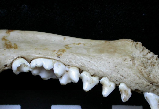 Lower teeth