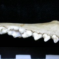 Dentition inférieure