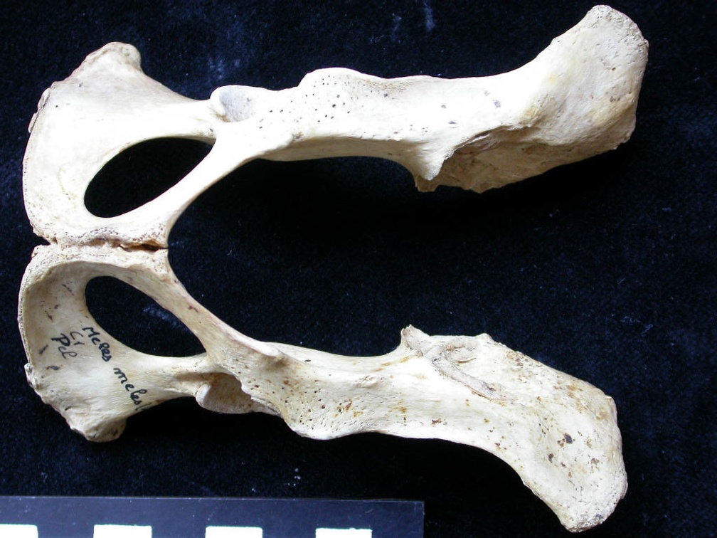 Pelvis