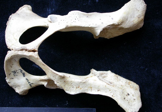 Pelvis