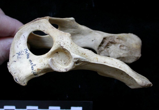 Pelvis