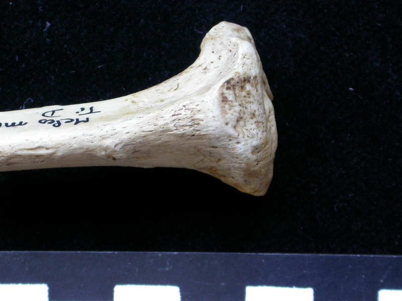  Tibia: proximale part