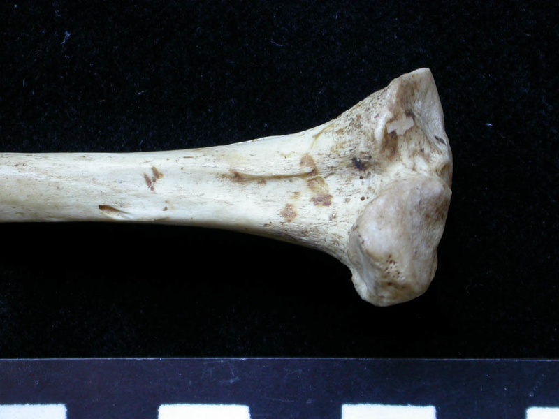  Tibia: proximale part