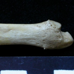 Ulna : partie distale