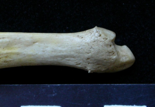 Ulna : parte distal