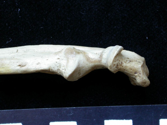  Ulna: proximale part