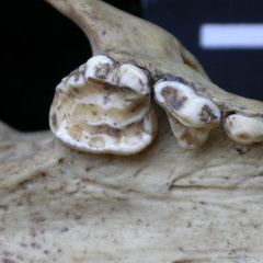 Dentition supérieure