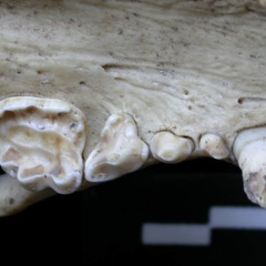 Dentition supérieure