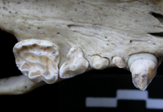 Dentition supérieure