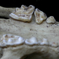 Dentition supérieure