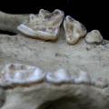 Dentition supérieure