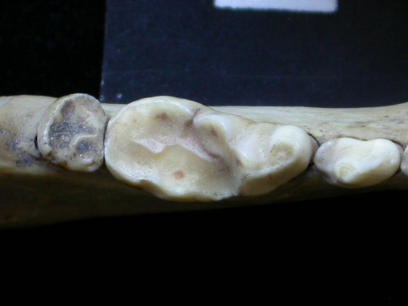 Dentition inférieure