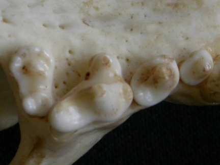 Dentition supérieure