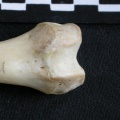 Fémur : parte distal