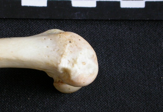 Femur: distal part