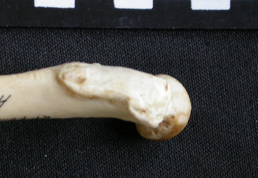 Femur: proximale part