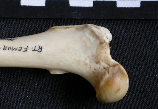 Femur: proximale part